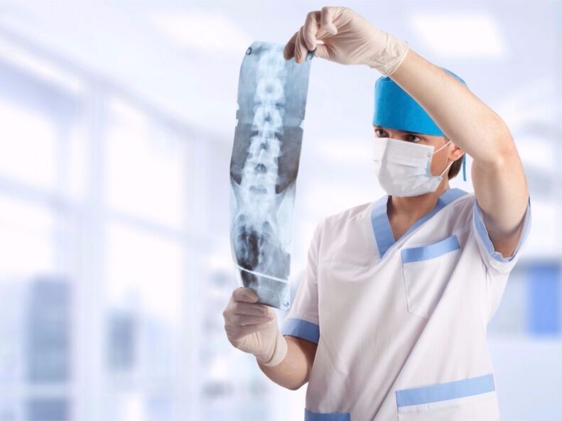 zdravnik pogleda posnetek vratne hrbtenice z osteohondrozo