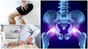 klasifikacija osteohondroze hrbtenice