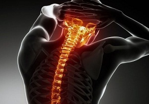 pravila za zdravljenje osteohondroze vratne hrbtenice