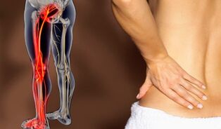 Značilnosti bolečin v hrbtu