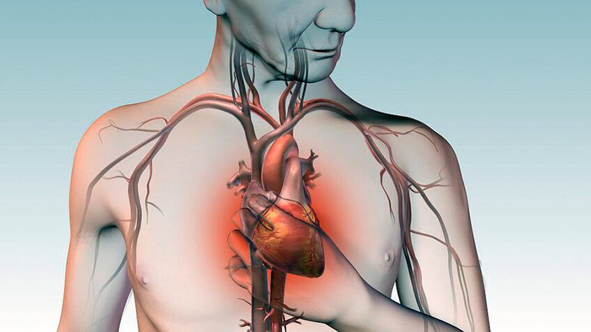 Bolečina pod lopatico in bolečina pod pritiskom za prsnico s srčnimi boleznimi